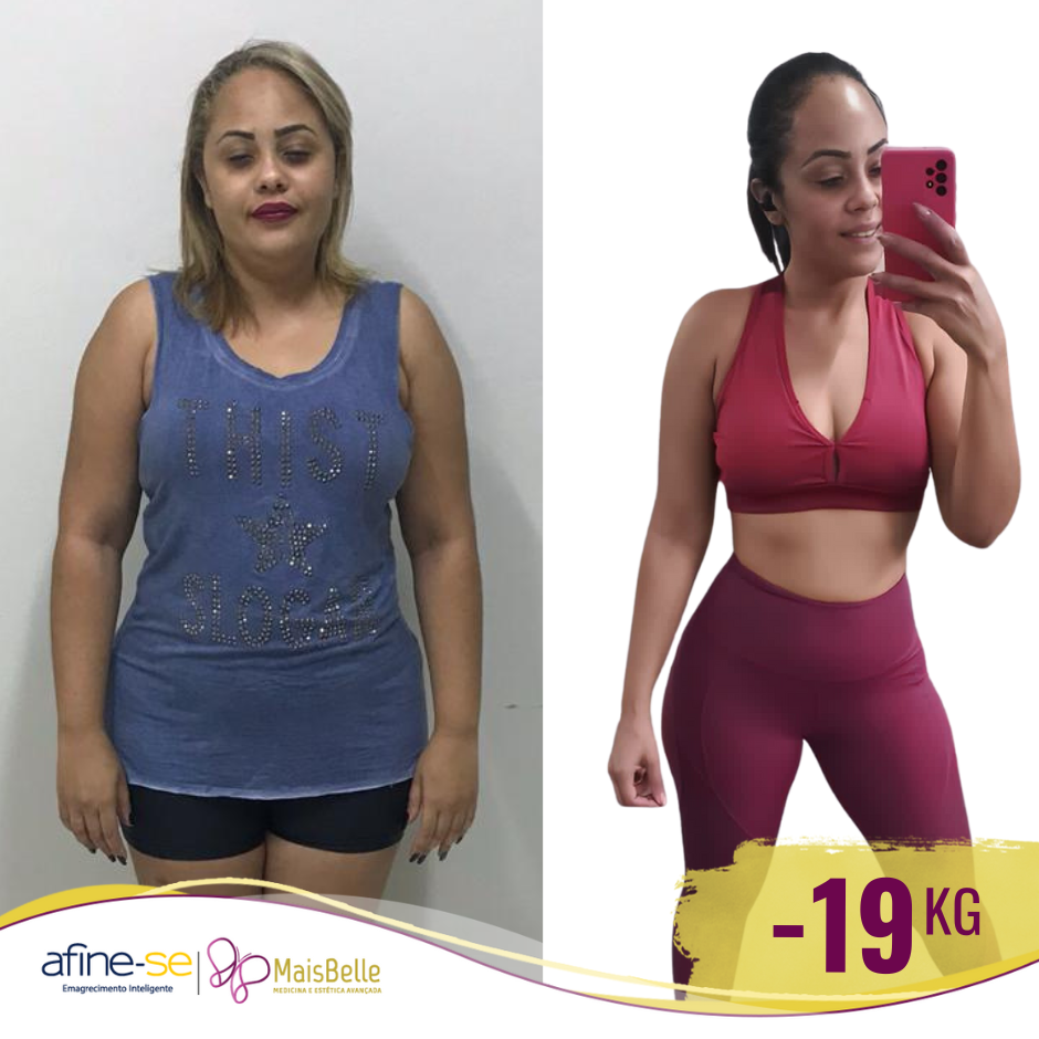 Antes e Depois_Barbara Novo - MaisBelle