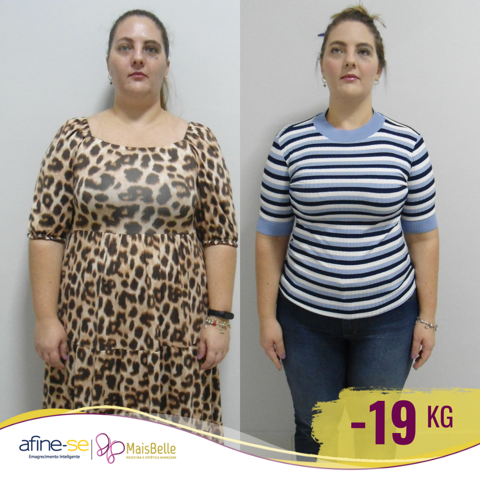 Antes e Depois_Luamaika 19kag