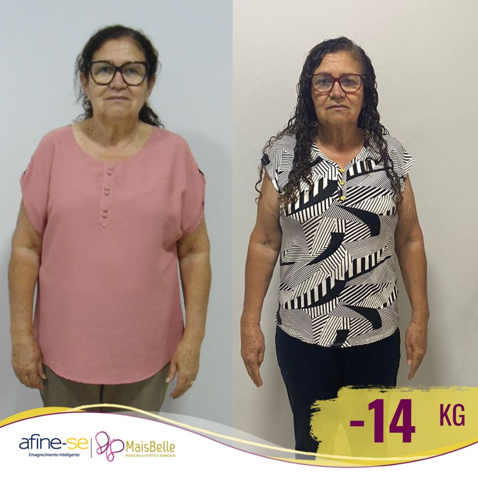 Antes e Depois_Maria Inacia 14a