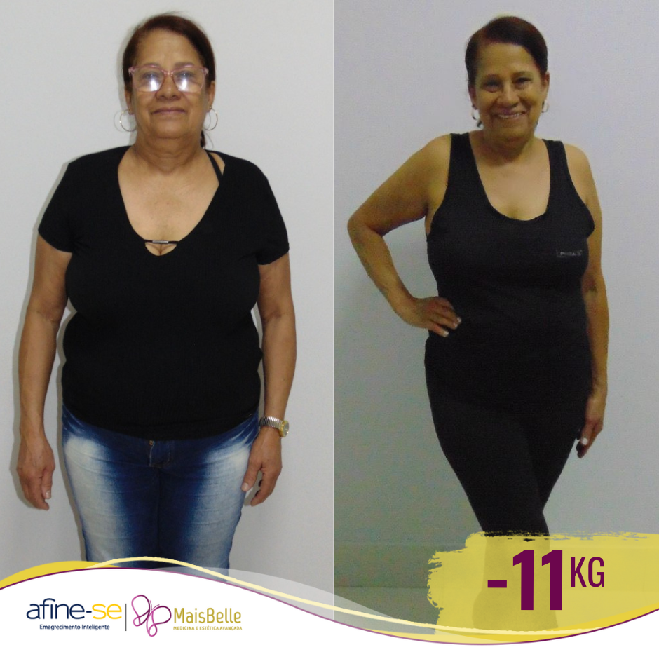 Antes e Depois_Maria José -11a