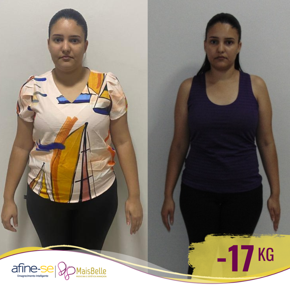 Antes e Depois_Rafaela -17a