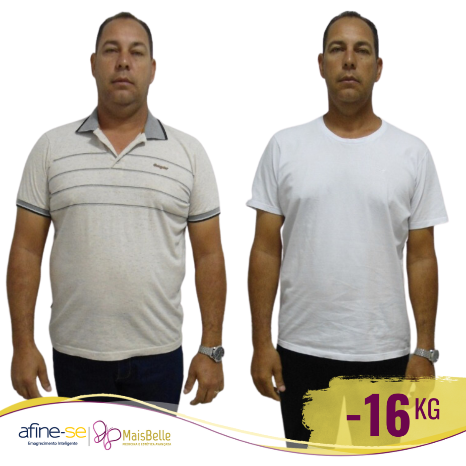 Antes e Depois_Ricardo 16a