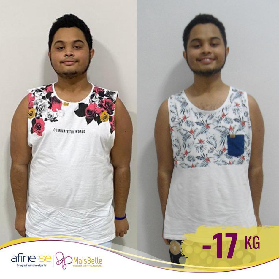 Antes e Depois_WhatsApp Image 2023-07-20 at 11.57.44 (1)