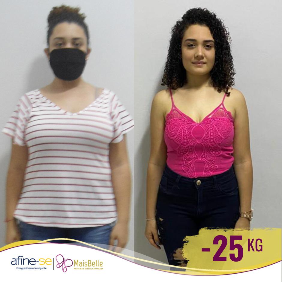 Antes e Depois_WhatsApp Image 2023-07-20 at 11.57.44