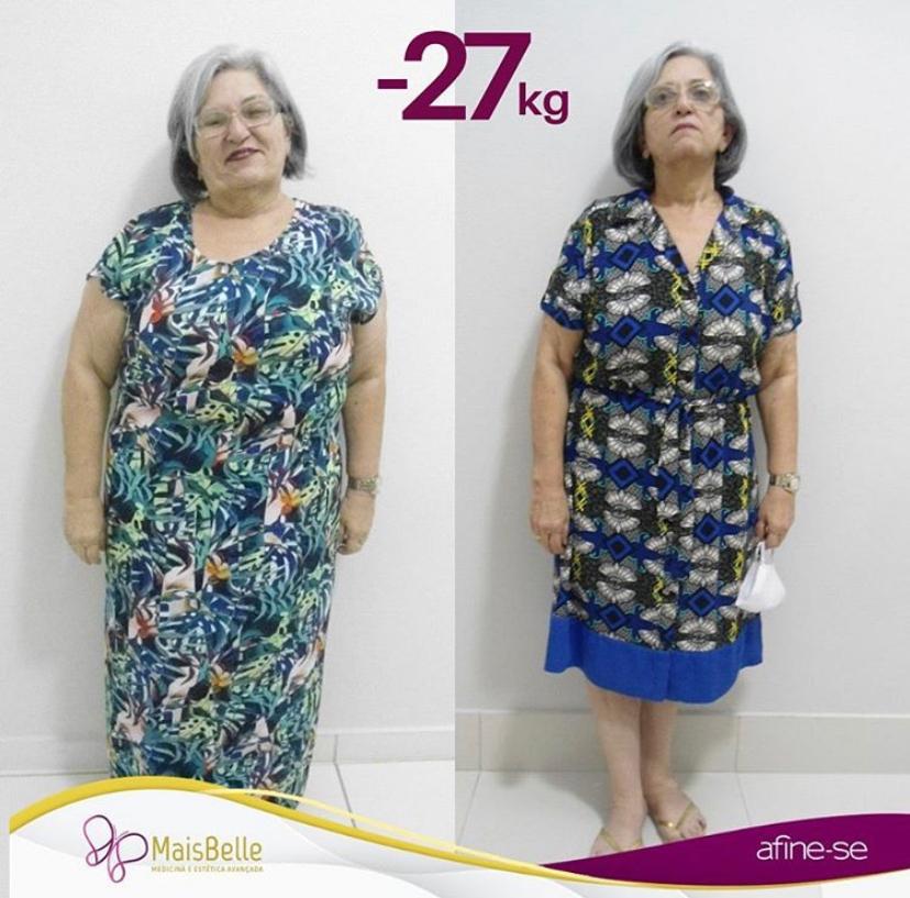 Antes e Depois_WhatsApp Image 2023-07-20 at 11.58.34