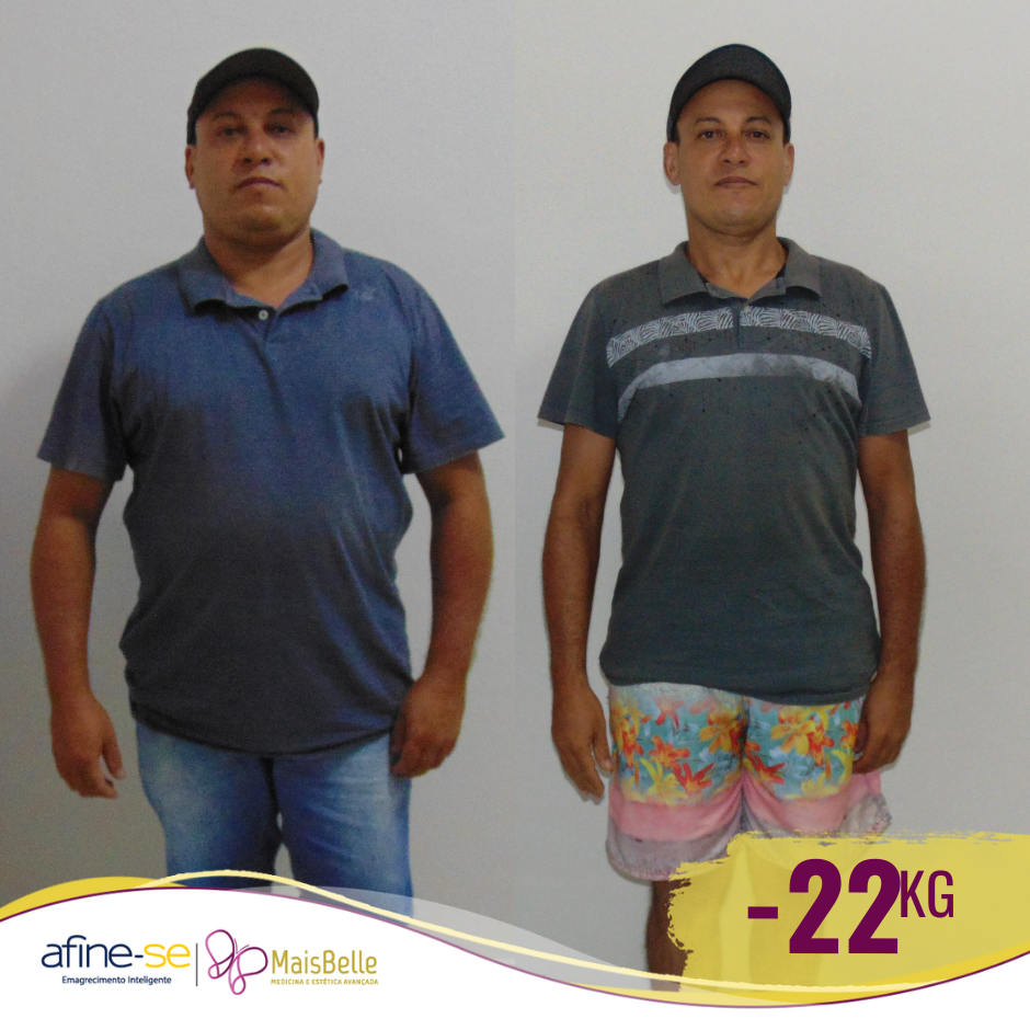 Antes e Depois_aMateus Evani -22